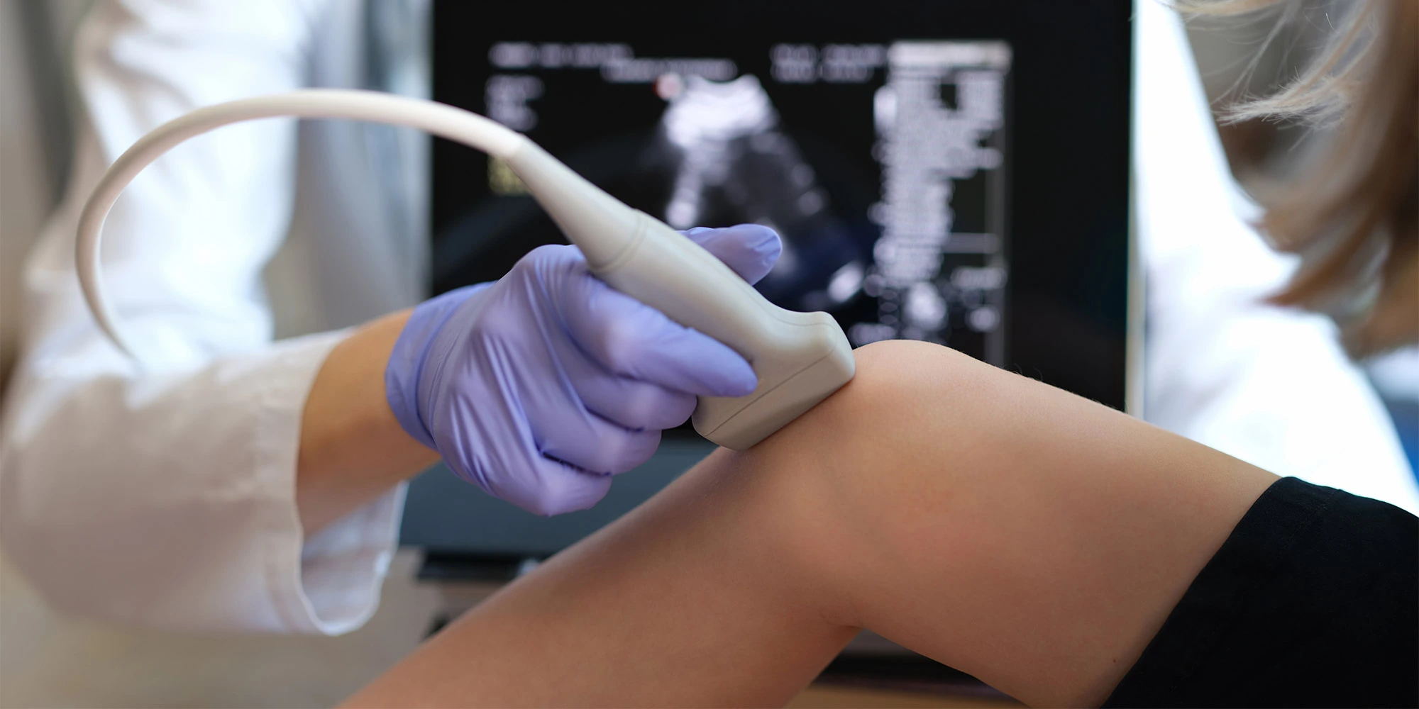 Ultrasound Technology: Significance, Applications and Advantages