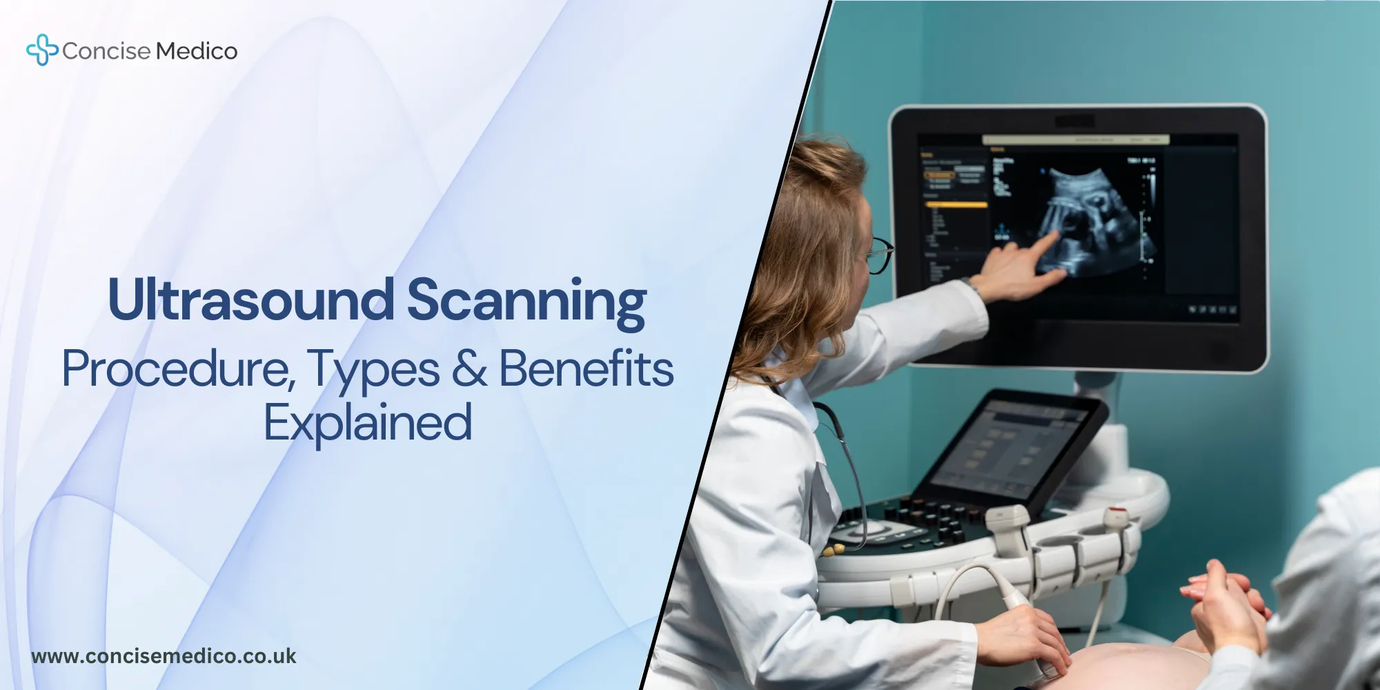 ultrasound scanning