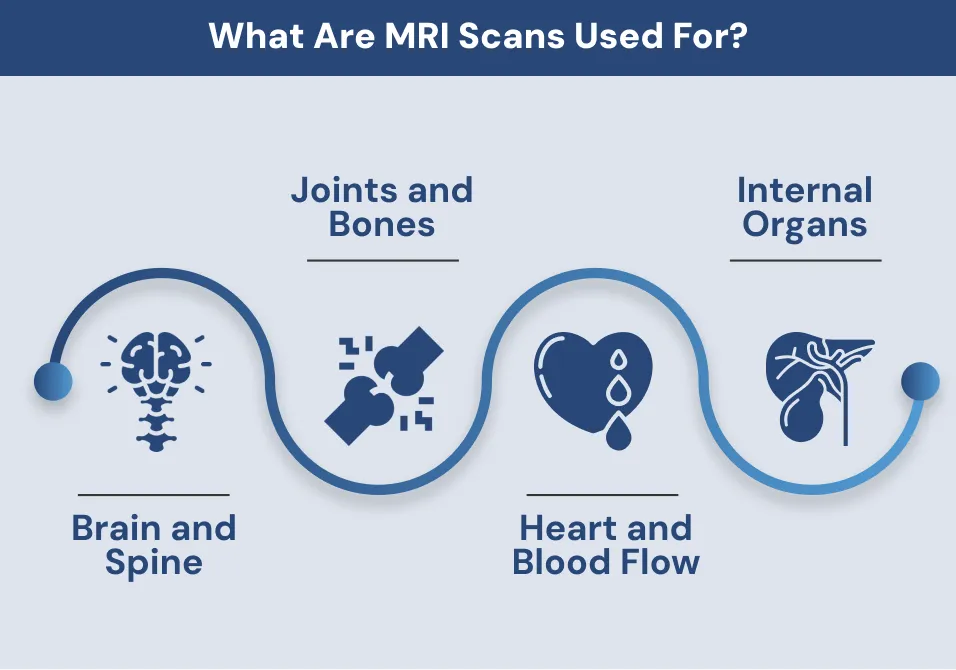 What Are MRI Scans Used For?