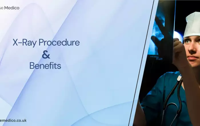 X-Ray scan legal importance in UK
