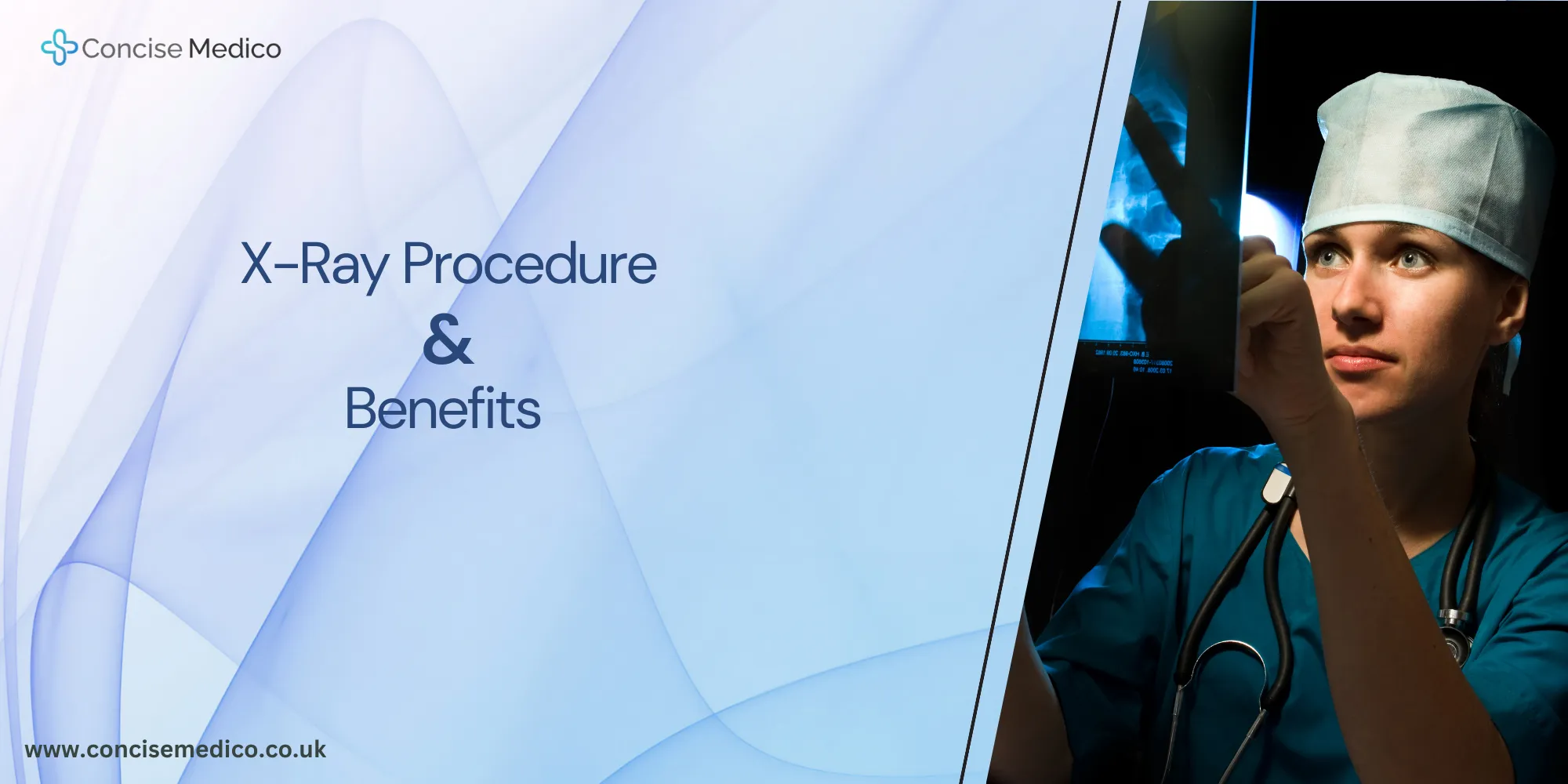 X-Ray scan legal importance in UK