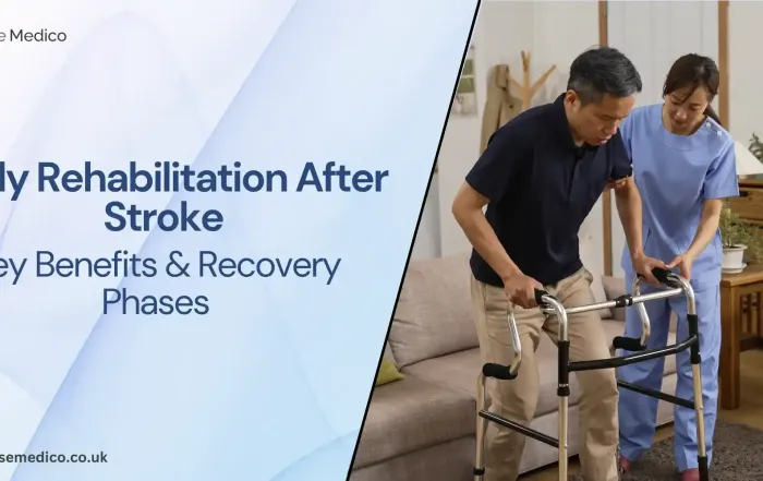early rehabilitation after stroke