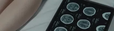 CT Scan